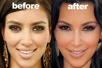SEE Kim Kardashian Before &amp; After Plastic Surgery (PHOTOS ...
