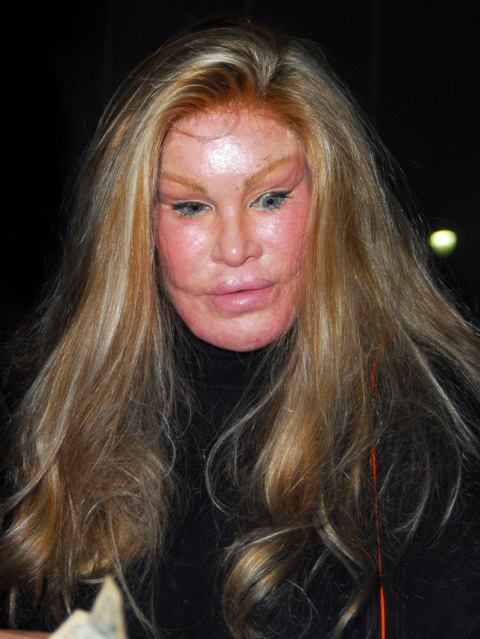 awful plastic surgery. Worst Clebrity Plastic Surgery