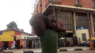 Boy With Giant Hand Found Begging On Lagos Street (Graphic Photos) 2601347_1_jpeg83b5009e040969ee7b60362ad7426573