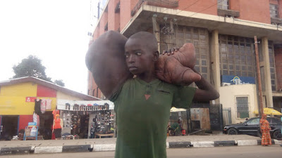 Boy With Giant Hand Found Begging On Lagos Street (Graphic Photos) 2601348_2_jpeg_jpeg05da5cee37071babb0ffd6782b75f12f
