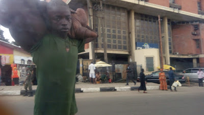 Boy With Giant Hand Found Begging On Lagos Street (Graphic Photos) 2601349_3_jpeg_jpeg5bd60a09ffe46e48cad952ac1671dd1e