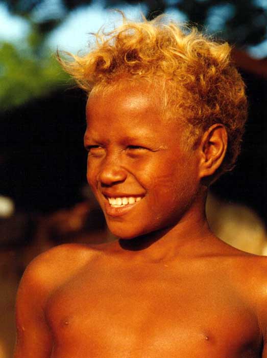Albino Black People. Black Parents, White Blond