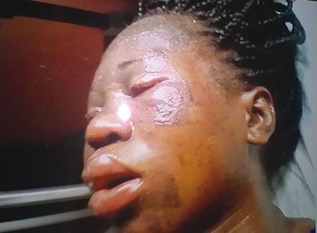 GOD!!!!!  25-years-old Woman Bathed With Hot Oil Loses Pregnancy In Lagos 