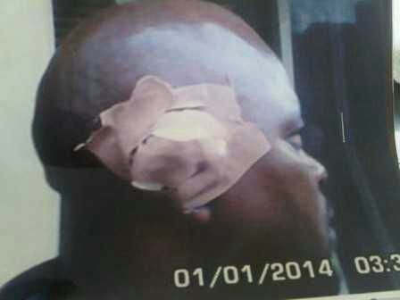 WHAT A WORLD!!!!!!! 60-year-old single mother Cuts Off Neigbour’s Ear With Table Knife