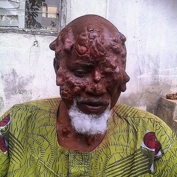 Advanced Nollywood Special Makeup Effect [ Graphic Images] 3082617_inst10sffx_jpeg416e6a4703b45eb810ec7c7a1f0f2bcb