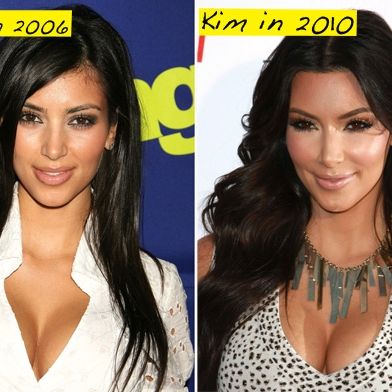 kim kardashian plastic surgery before and after face. To Kim Kardashian#39;s Face?