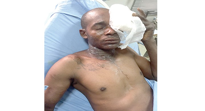 OMG!!!!! Hoodlums Bathe Task Force Official With Acid In Lagos 