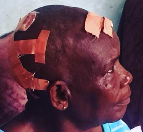 68-Year-Old Woman Battered By Her 79-Year-Old Husband In Lagos 3462610_12_jpegd077e4317cde1e70737c7d5616929159