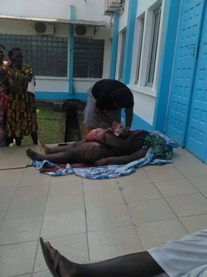 Pregnant Woman Rejected By Cameronian Hospital,Operated By Her Niece In Open Air 3489083_128147422242436612592294325976363744005570n_jpeg23bcd21e657cdc77bee225ff32bdcefa