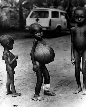 Biafra: The Nigerian Civil War In Pictures (Warning Disturbing Images) 374415_Biafran_Children_jpg229e8e954ca1618371cc08fbf4b2059a