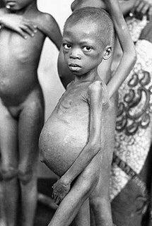 Biafra: The Nigerian Civil War In Pictures (Warning Disturbing Images) 374425_biafra4_jpg1d33ea65208e7d7e96c4584efc10fc72