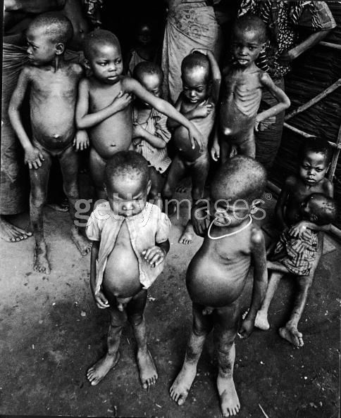 Biafra: The Nigerian Civil War In Pictures (Warning Disturbing Images) 374446_Starving_Children_jpgd609112d438f233e6033435918ce2e4a
