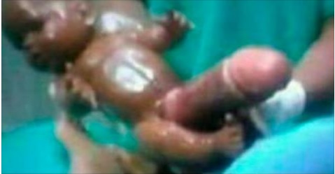 Baby With Large Penis 2