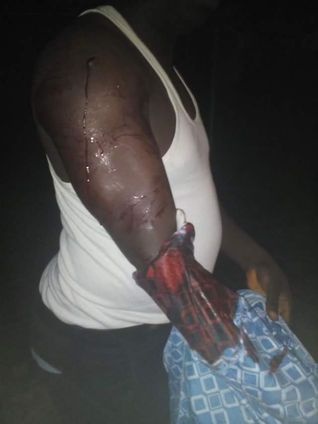 Armed Robbers Shoot Silver Etieyibo In Delta On His Way To His House (Pics)  4219931_fbimg1473509627061_jpeg23b1be7bc45bcafd18d5bba2937753ba