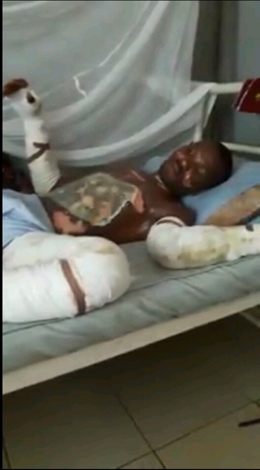 Fire Burns A Man In His House In Rivers State (Photos) 4511804_20161121140740_jpeg16d03ab2eb76acf102bb52417451aed3