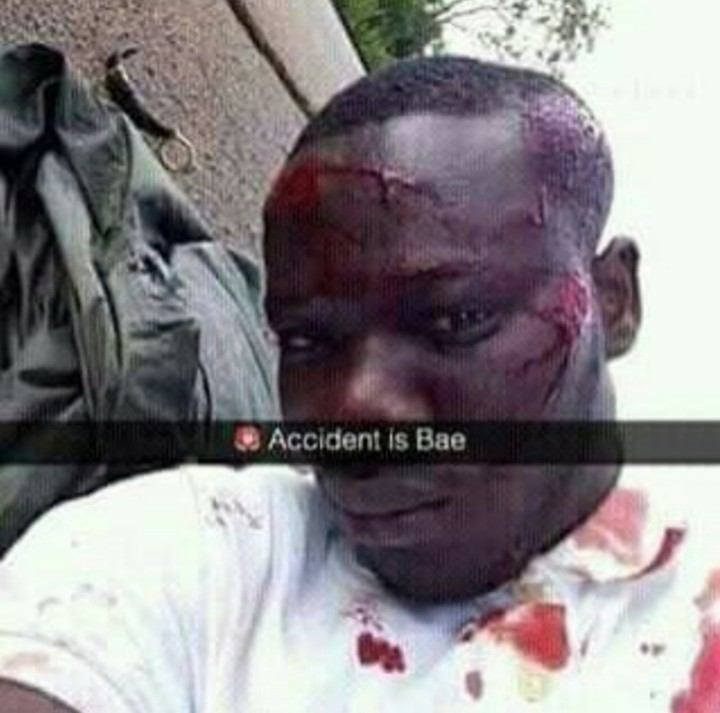  Guy Snaps Himself In A Ghastly Accident 4529024_img20161125024545_jpega66d81a23143d1e8f60c121c3675b2e8