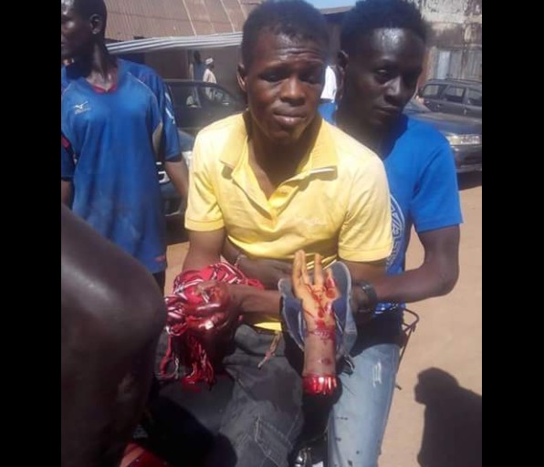 Man's Hand Cut Off In Jos During Violent Clash. Graphic Photos 4539704_capture_jpeg6d0ce43c2e6495dc5ba7597dd3872afd