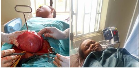 See The Massive Fibroid Doctors Removed From A Woman's Stomach. Graphic Photos 4605530_capture_jpeg6d0ce43c2e6495dc5ba7597dd3872afd