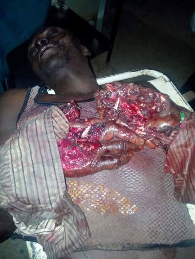 Killing Of Southern Kaduna People By Fulani Herdsmen (Graphic Photos) 4675761_fbimg1483092654710_jpeg322ef9f8279e1b09df368c2087c3bde0