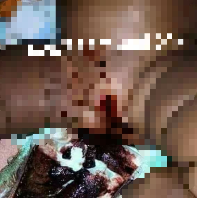 11-Month-Old Baby Raped By Her Uncle Ogun Bleeds Endlessly (Graphic Photo)  4925536_cymera20170227075254_jpeg99fee0bd7eda42d29f3ec912a4e31d57