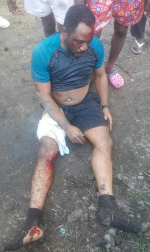 Medical Doctor Knocked Down While Jogging In Lagos 5120864_accident_jpeg31c51a8c9dbe58f807a85d6442fe4b6a