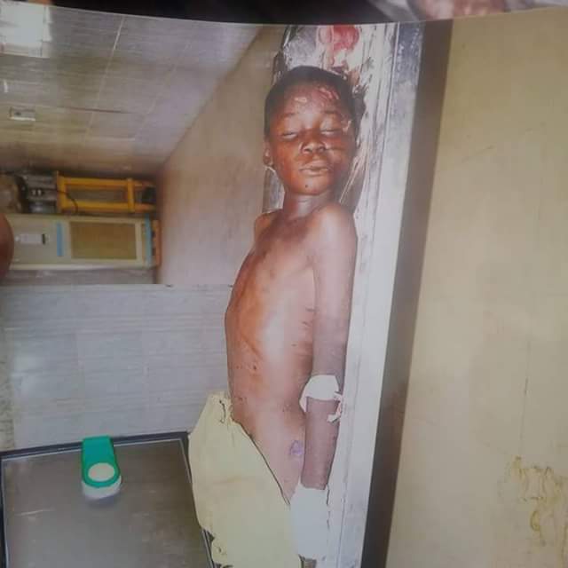 Unidentifiable Boy Killed By A Car In Kano (Disturbing Photo) 5145374_fbimg1491997053174_jpeg8516d0ff6d38a8cf9b942fa776e23944