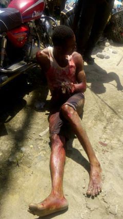 Two Kidnap Suspects Killed In Abia, Two Arrested (Graphic Photos) 5167112_kidnapperskilledinabia_jpeg7b951394a4570cab7afe3c1e833bb443