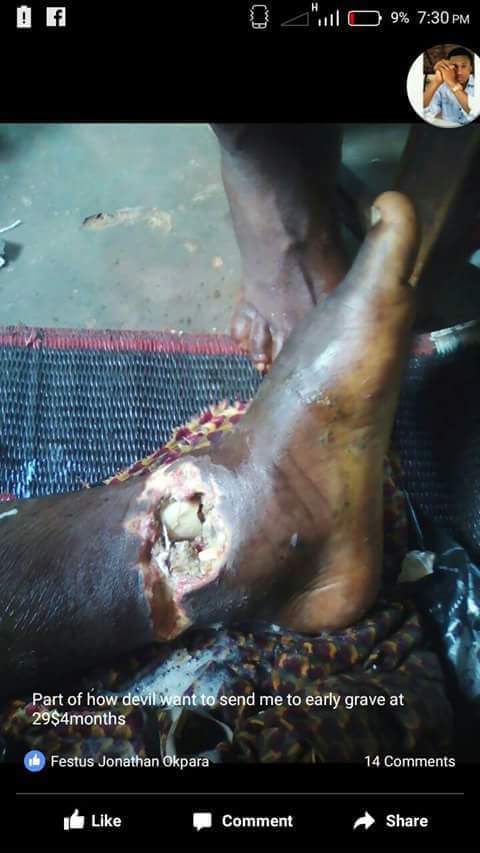 Man Falls From 3 Storey Building In Imo, Breaks His Left Leg (Graphic Photos) 5179682_fbimg1492609895512_jpeg537b4341ea3cedd0bcc3324466c3ed9a