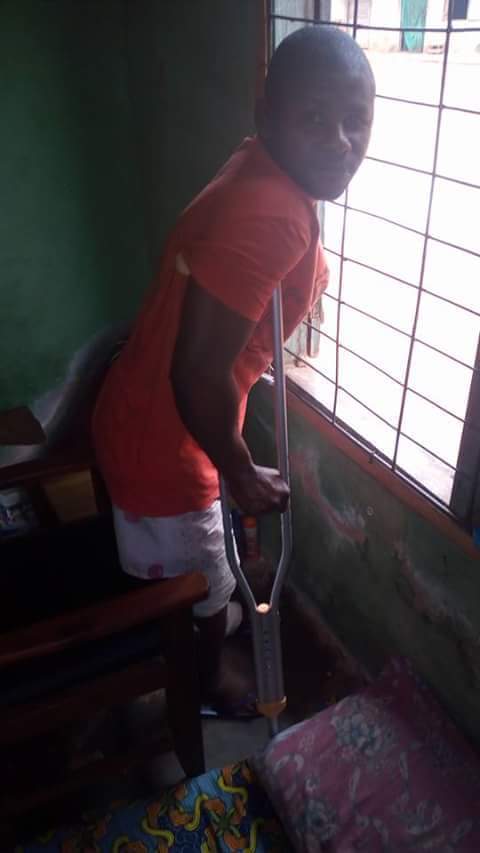 Man Falls From 3 Storey Building In Imo, Breaks His Left Leg (Graphic Photos) 5179683_fbimg1492609889551_jpeg91c8b7f1938f2a78711083e03520d56f
