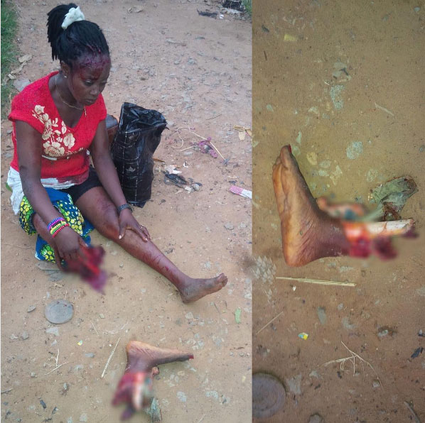 Train Cuts Off Woman's Leg At Urrata, Aba, Abia State (graphic Picture) 5181520_womantrainaba_jpeg28508cd9b479fde290bfe67a1bcf08a8