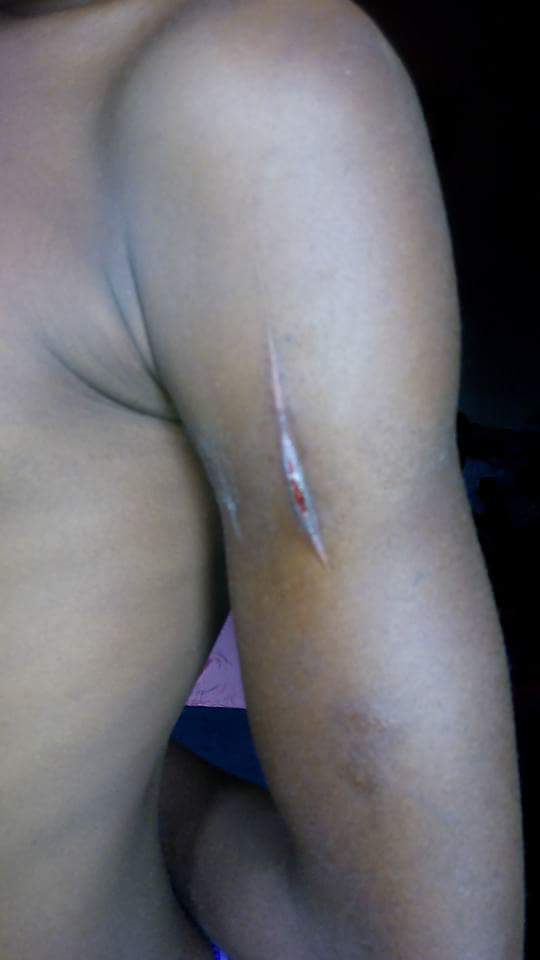 Woman Stabs Her Hungry Maid With Knife In Calabar For Taking Food From Pot 5229515_fbimg1493462624958_jpeg71de368ac0641a24cb4e93afb0d1c5cb