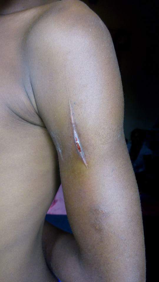 Woman Stabs Her Hungry Maid With Knife In Calabar For Taking Food From Pot 5229516_fbimg1493462617845_jpegca1963b3e07fa6f1b1fe18d85d1a5325
