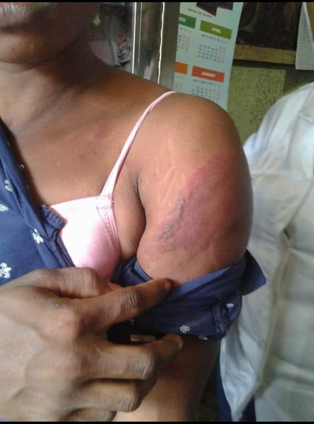 Wife Battered By Husband In Lagos After She Discovered He's Dating Another Lady 5229933_fbimg1493467418275_jpeg09867a47fc88d70f187b615c3e485176