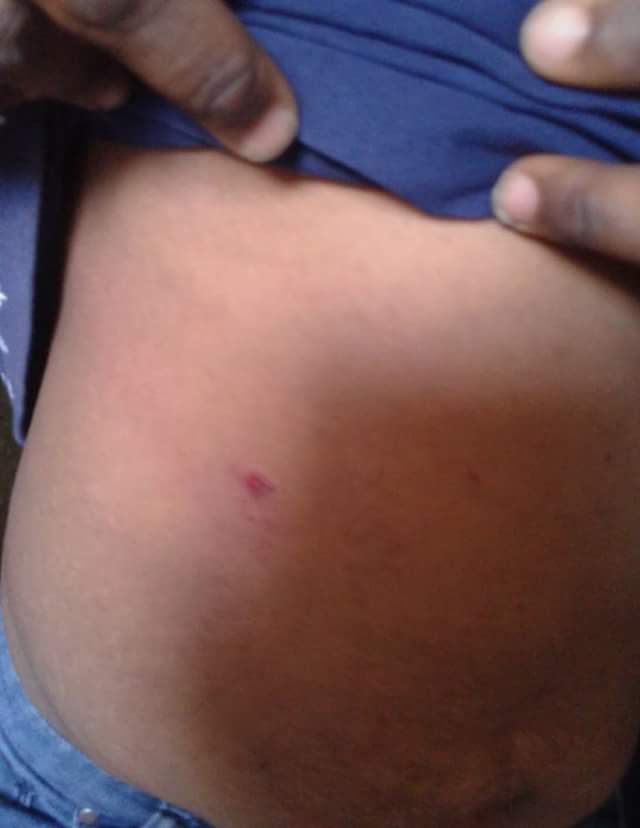Wife Battered By Husband In Lagos After She Discovered He's Dating Another Lady 5229948_fbimg1493467437240_jpeg66ca4d3551860efc7fd04523d8d4e08b