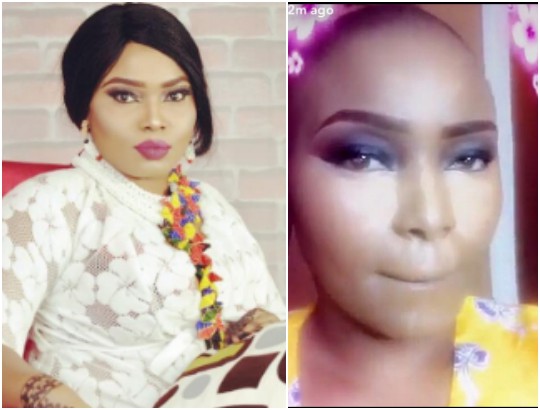 Image result for Halima Abubakar Goes Bald Following Drug Reactions After Her Surgery. (Photo)