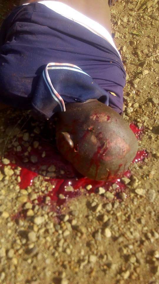 Hit And Run Honda Driver Kills A Man Today In Otukpo,Benue(Graphic Pics) 5729843_fbimg1501267783566_jpeg3a6b18b0bf900f4a80499118d8d12d82
