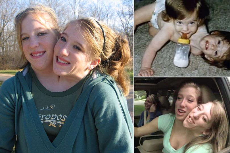 Abby and Brittany Hensel, 29, are one of only 12 sets of conjoined twins in...