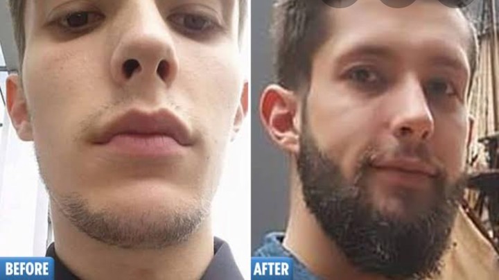He Applied This On His Beard, See What Happened ...