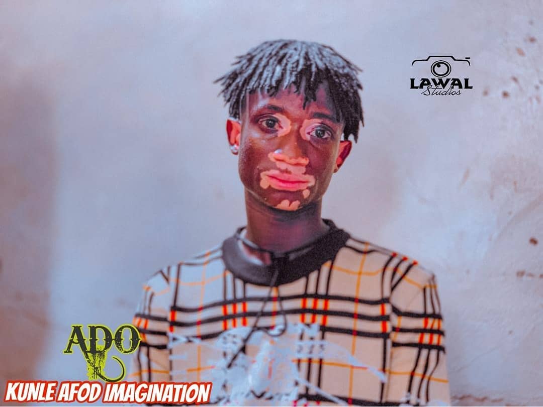ADO: Kunle Afod's Movie About Vitiligo (Photos) 13251560_kunleafod202103120002_jpegfb1f50a5e5c5fa256a24b8662e53028a