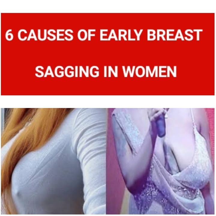 SAGGY BREASTS: Why Some Women Have Them And Others Don't [PHOTOS