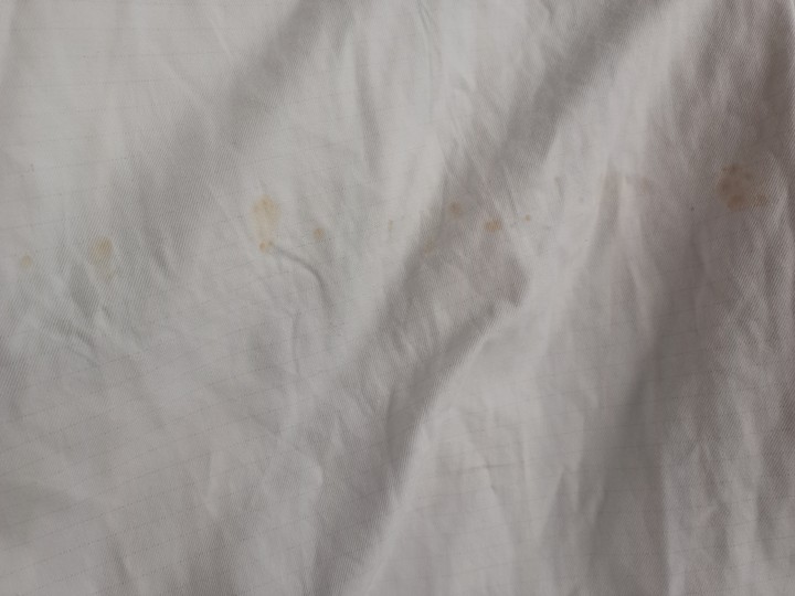 I Keep Seeing Brown Spots On Most Of My Shirts. - Family - Nigeria