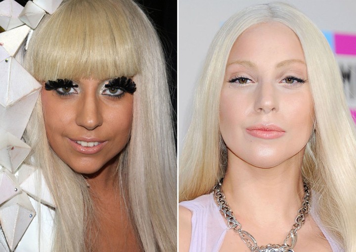 Lady Gaga Has Had A Nose Job ? 