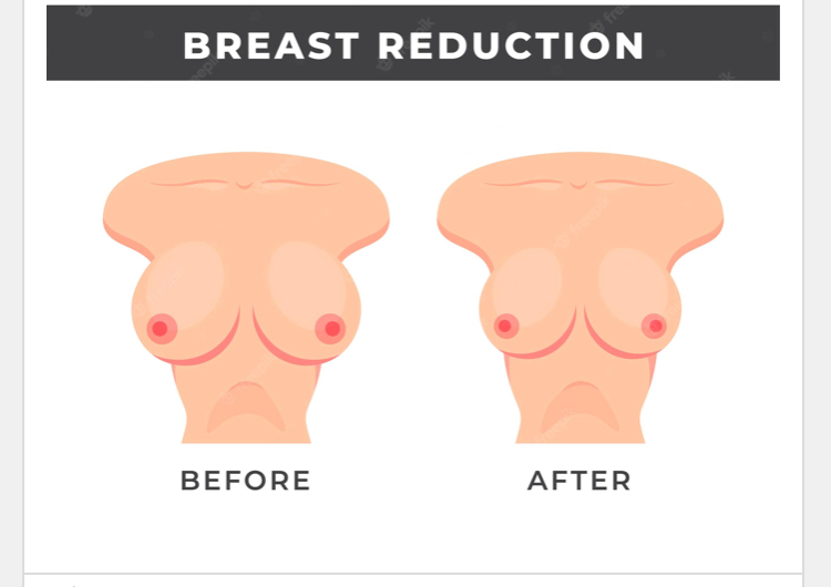 If Your Left Breast Is Bigger Than The First One, This Is What It Means -  Health - Nigeria