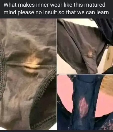 What Causes This Stain In Pants? (Photos) - Health - Nigeria