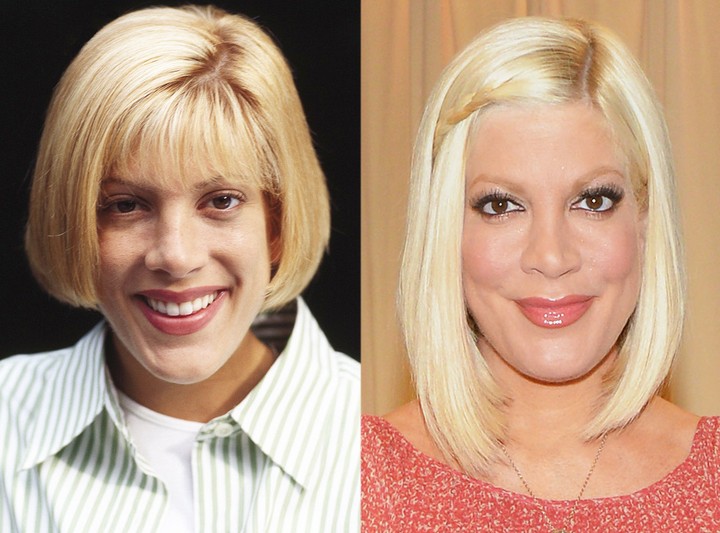 21 Celebrity Plastic Surgery Nightmares: Before & After ...