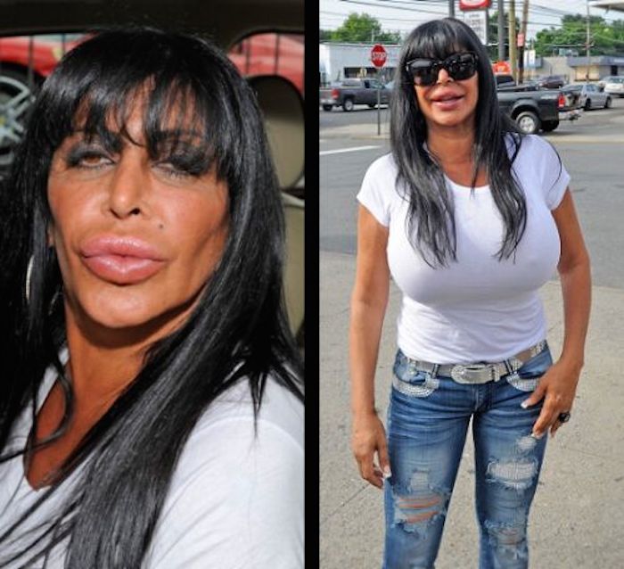 21 Celebrity Plastic Surgery Nightmares: Before & After - Celebrities -...
