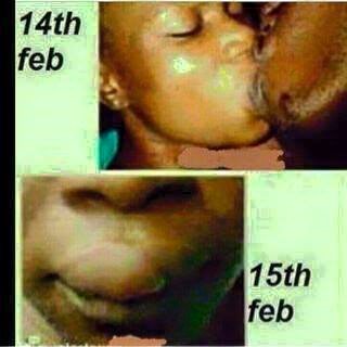 After Kissing My Girl On Valentine's Day This Is What I Got This Morning  .pic - Jokes Etc - Nigeria