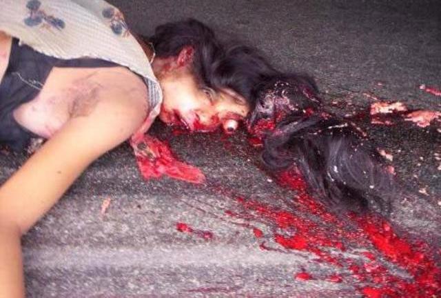Nasty effects of road accidents (caution very graphic and potentially offen...
