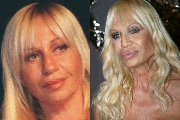 surgery bad plastic facelifts celebrity who celebrities cosmetic donatella too wrong gone versace took body far most after good nairaland