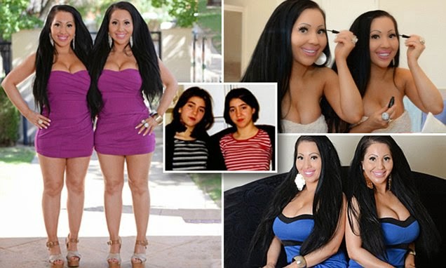 Meet The World's Most Identical Twins Who Spent $250k On Surgery &...